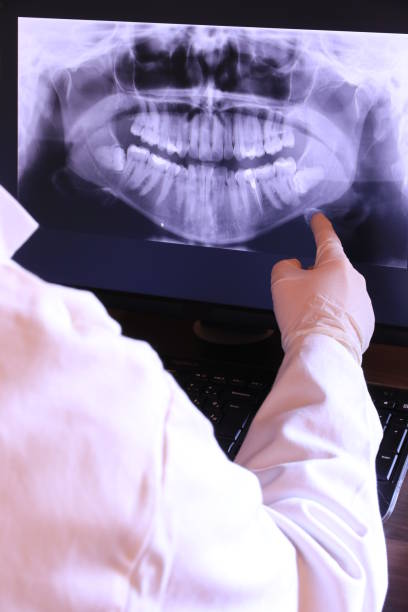 Best Emergency Dentist for Special Needs Patients in Spencerport, NY